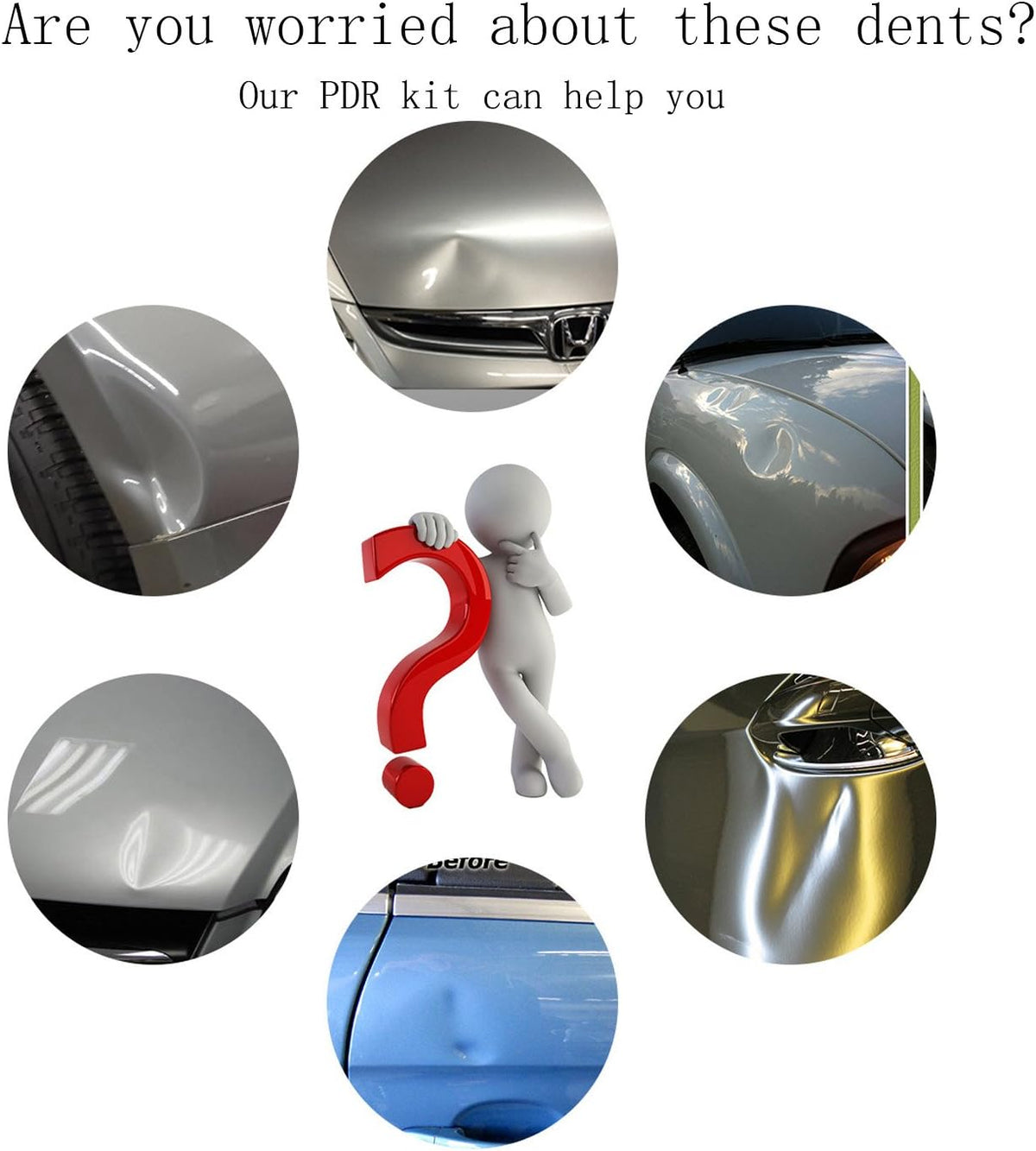 Dent Repair Kit with LED Light Board and Storage Bag F957529